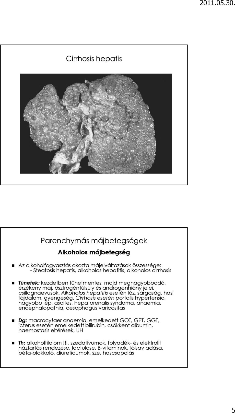 Cirrhosis esetén portalis hypertensio, nagyobb lép, ascites, hepatorenalis syndoma, anaemia, encephalopathia, oesophagus varicositas Dg: macrocytaer anaemia, emelkedett GOT, GPT, GGT, icterus esetén