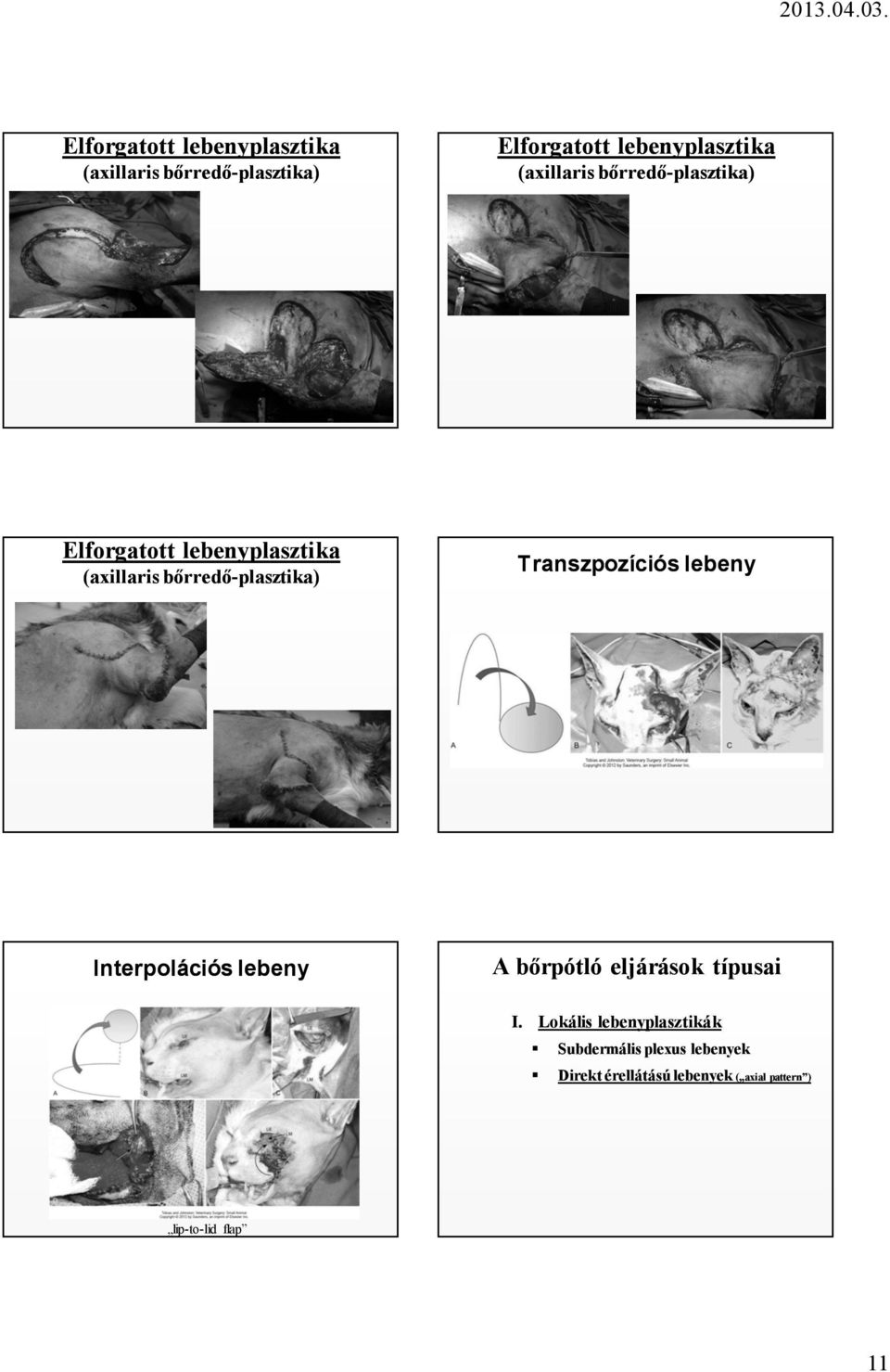 Transzpozíciós lebeny Interpolációs lebeny A bőrpótló eljárások típusai I.