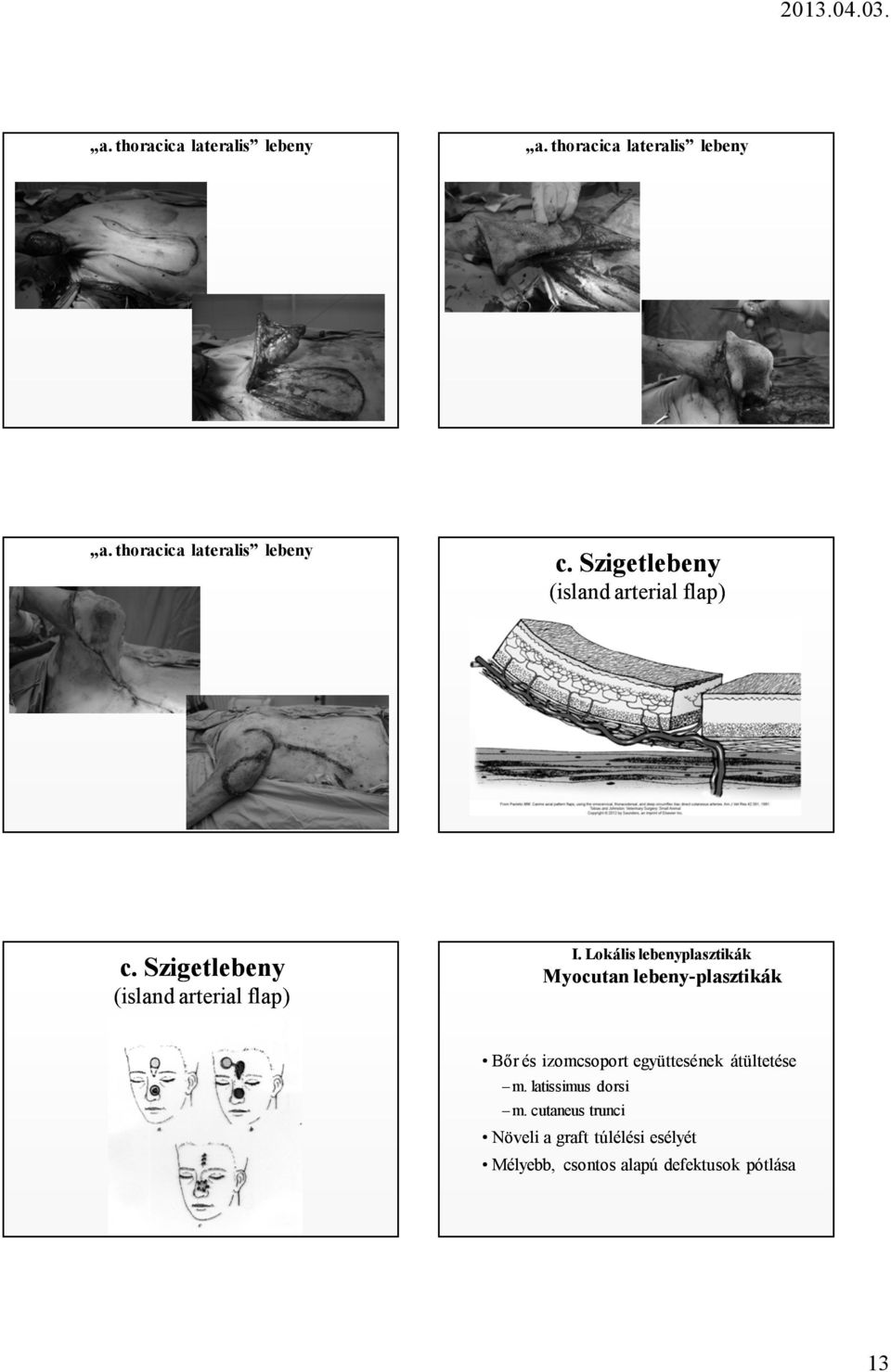 Lokális lebenyplasztikák Myocutan lebeny-plasztikák Bőr és izomcsoport együttesének átültetése