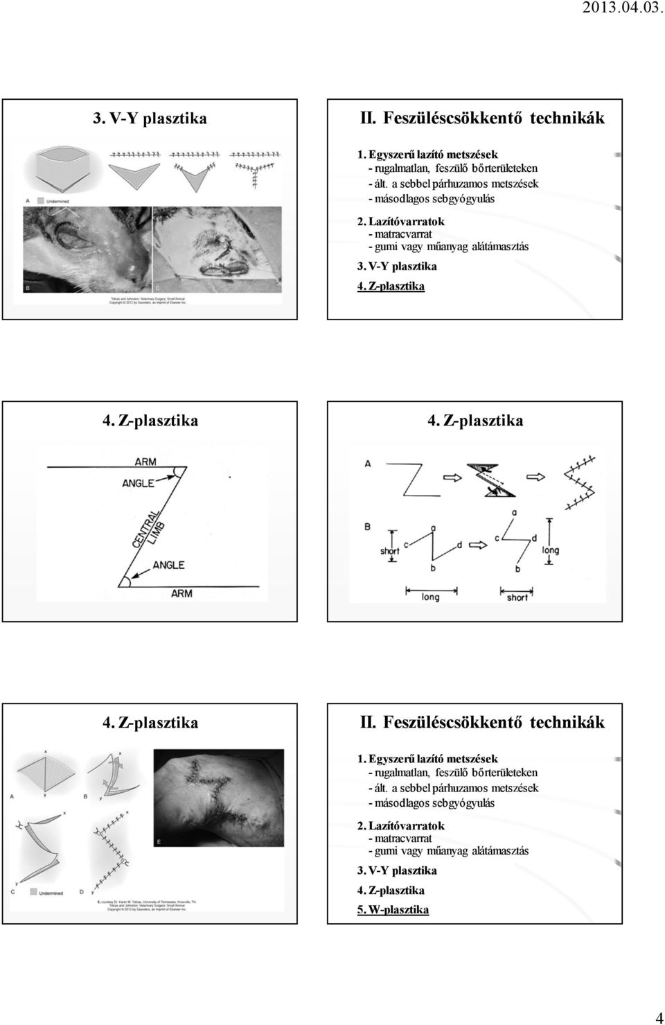 Z-plasztika 4. Z-plasztika 4. Z-plasztika 4. Z-plasztika II. Feszüléscsökkentő technikák 1.