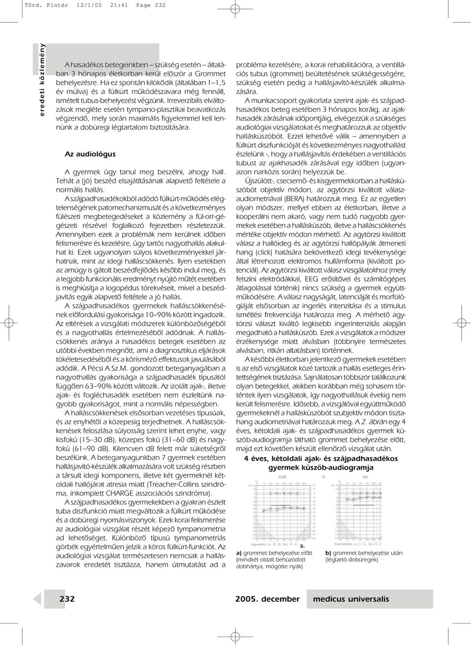 Irreverzibilis elváltozások megléte esetén tympano-plasztikai beavatkozás végzendô, mely során maximális figyelemmel kell lennünk a dobüregi légtartalom biztosítására.