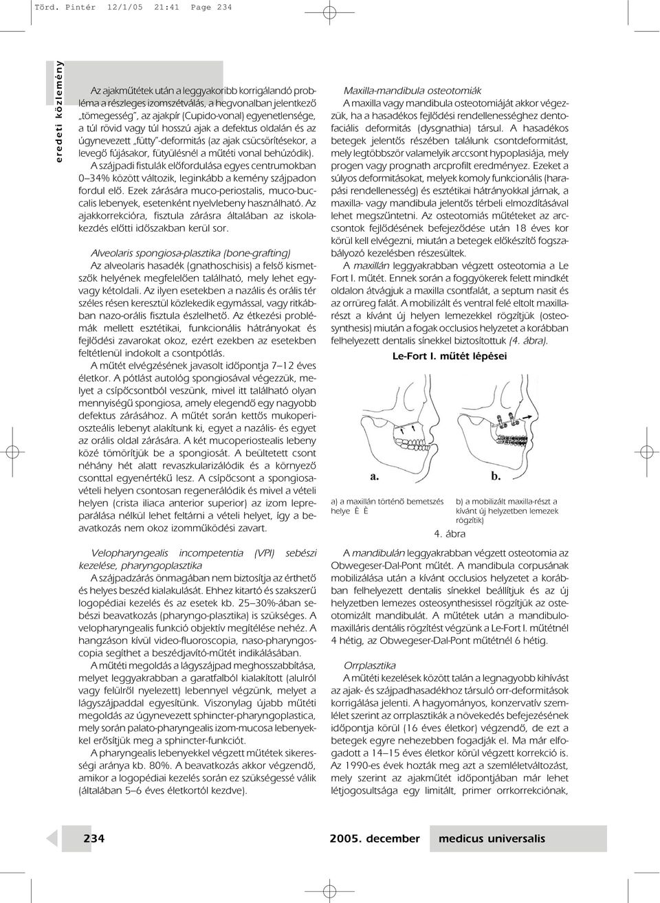 A szájpadi fistulák elôfordulása egyes centrumokban 0 34% között változik, leginkább a kemény szájpadon fordul elô.