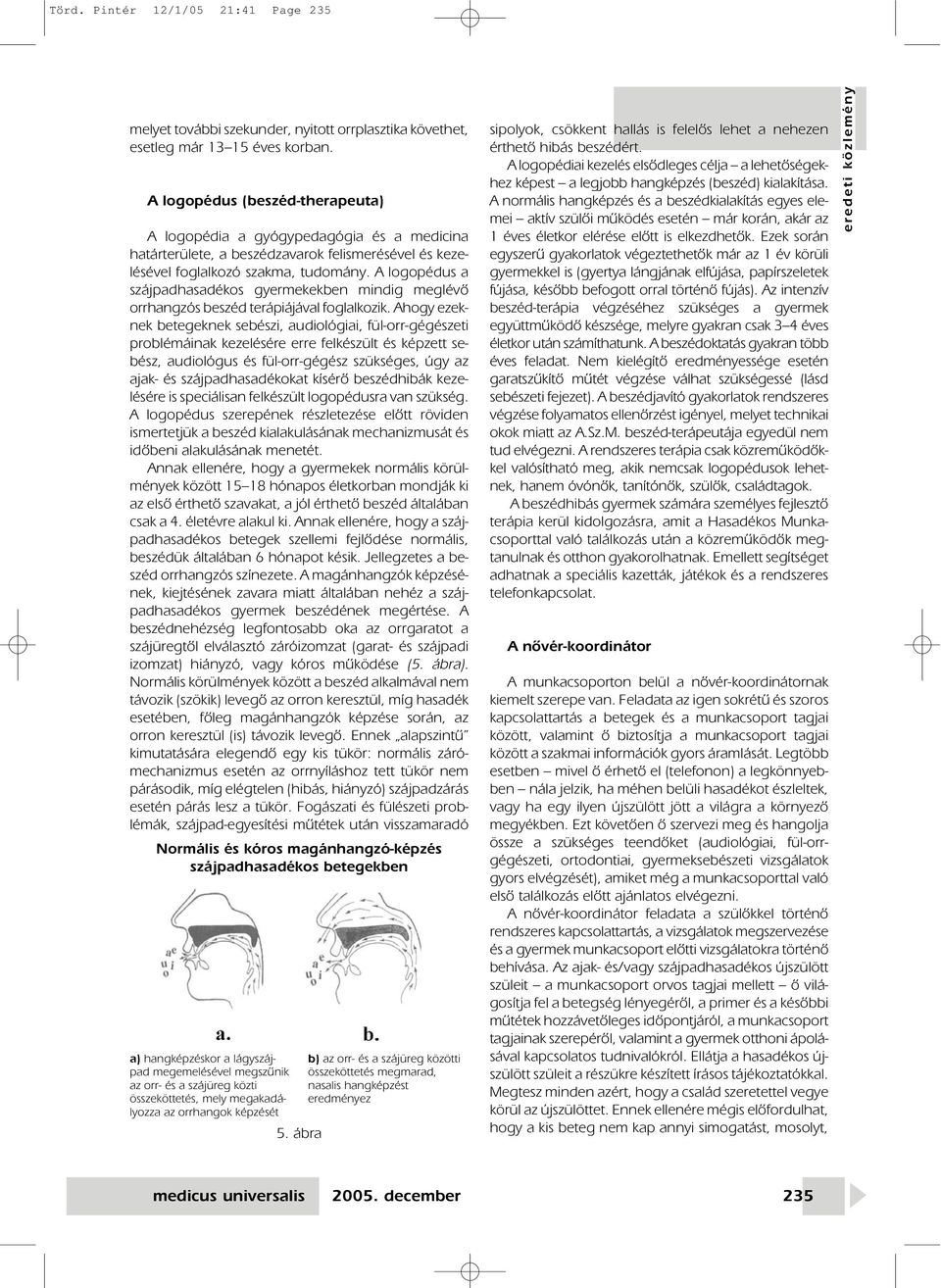 A logopédus a szájpadhasadékos gyermekekben mindig meglévô orrhangzós beszéd terápiájával foglalkozik.