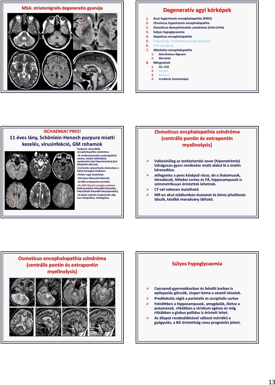 Marchiafava Bignami 2. Wernicke 8. Mérgezések 1. CO, CO2 2. Drogok 3. Metanol 4. Irradiáció, kemoterápia ISCHAEMIA? PRES!