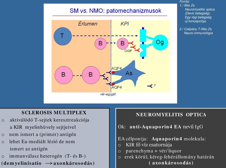 lehet Ea-mediált lézió de nem ismert az antigén immunválasz hetergén (T- és B-) (demyelinisati axnkársdás) NEUROMYELITIS OPTICA Ok: