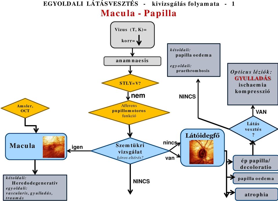 nem kétldali: papilla edema egyldali: praethrmbsis NINCS Opticus léziók: GYULLADÁS ischaemia kmpresszió Amsler, OCT Afferens