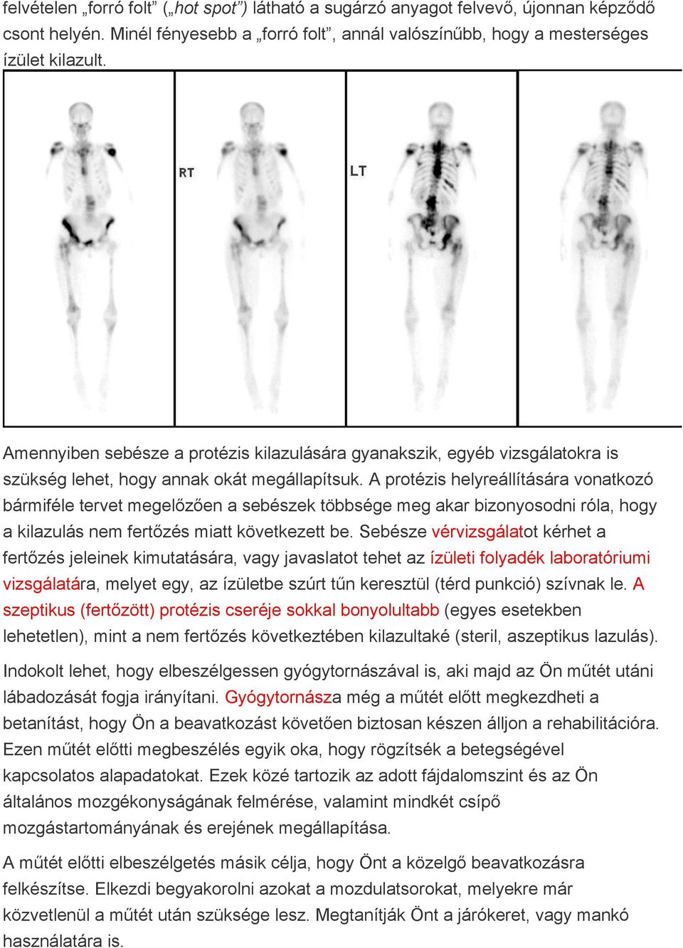 A protézis helyreállítására vonatkozó bármiféle tervet megelőzően a sebészek többsége meg akar bizonyosodni róla, hogy a kilazulás nem fertőzés miatt következett be.