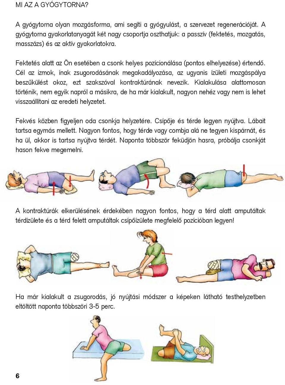 Fektetés alatt az Ön esetében a csonk helyes pozícionálása (pontos elhelyezése) értendő.