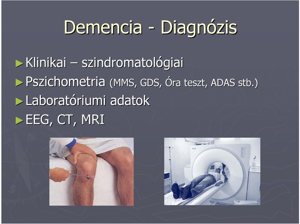 Pszichometria (MMS, GDS, Óra teszt,