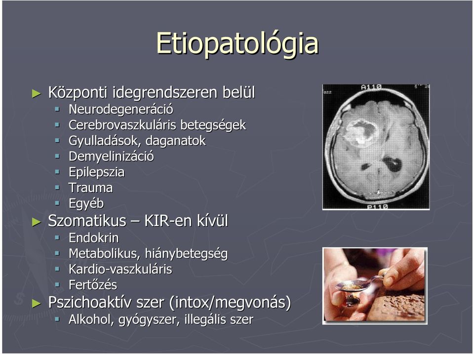 KIR-en kívül Endokrin Metabolikus,, hiánybetegs nybetegség Kardio-vaszkul vaszkuláris