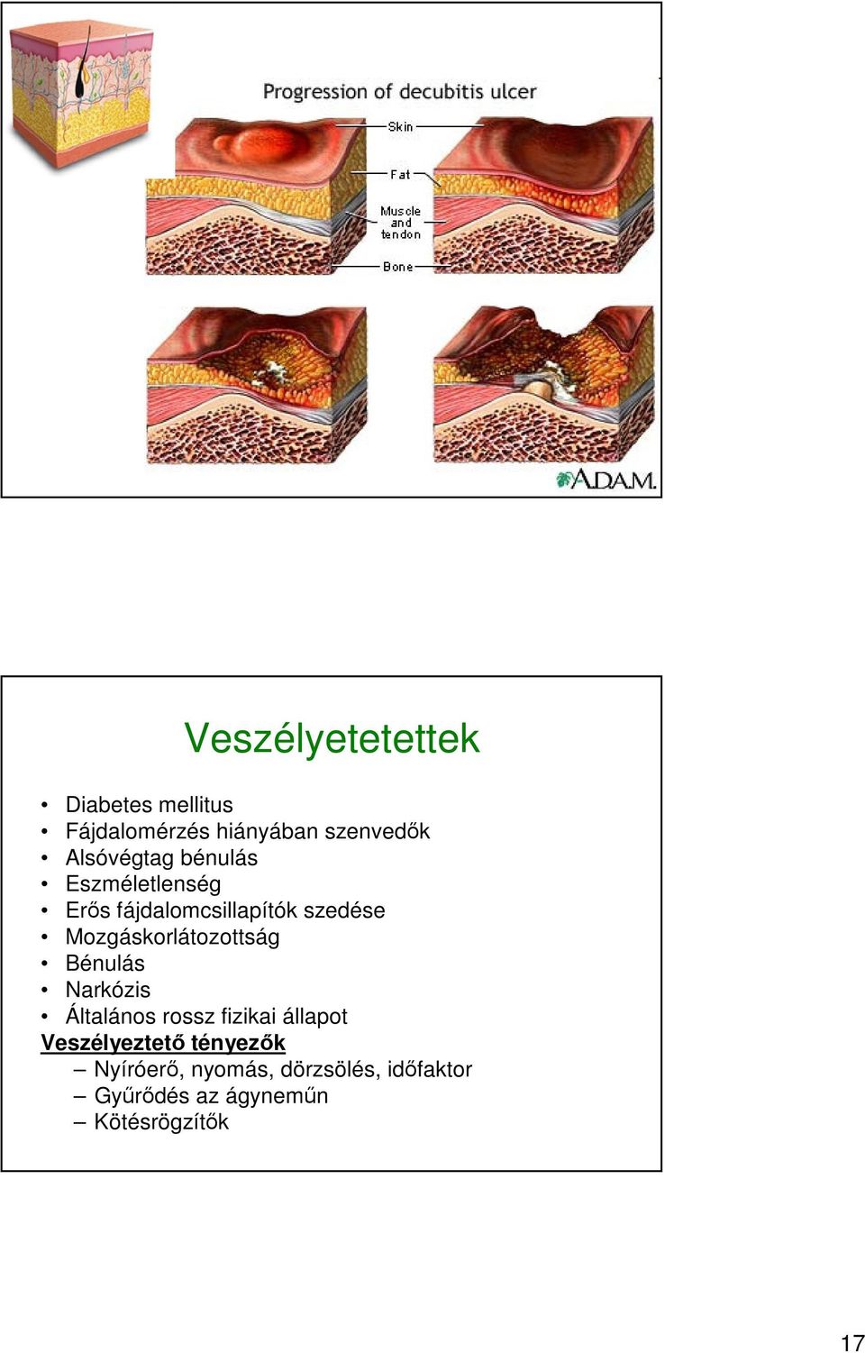 Mozgáskorlátozottság Bénulás Narkózis Általános rossz fizikai állapot