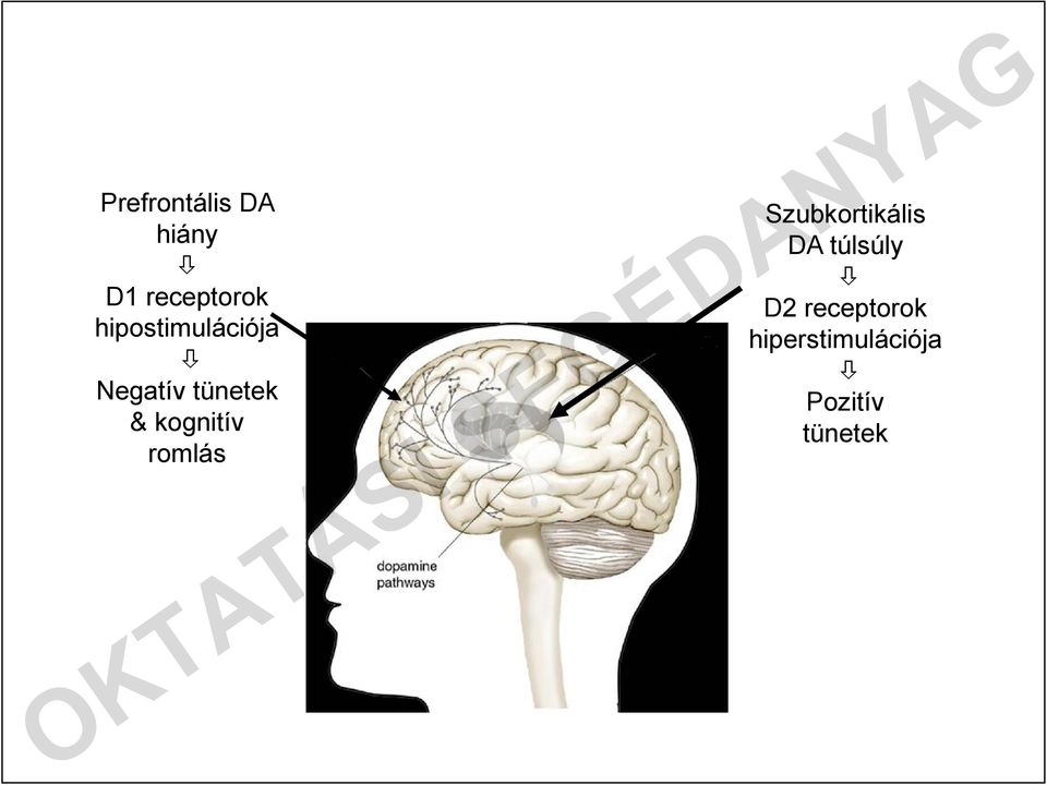 kognitív romlás Szubkortikális DA