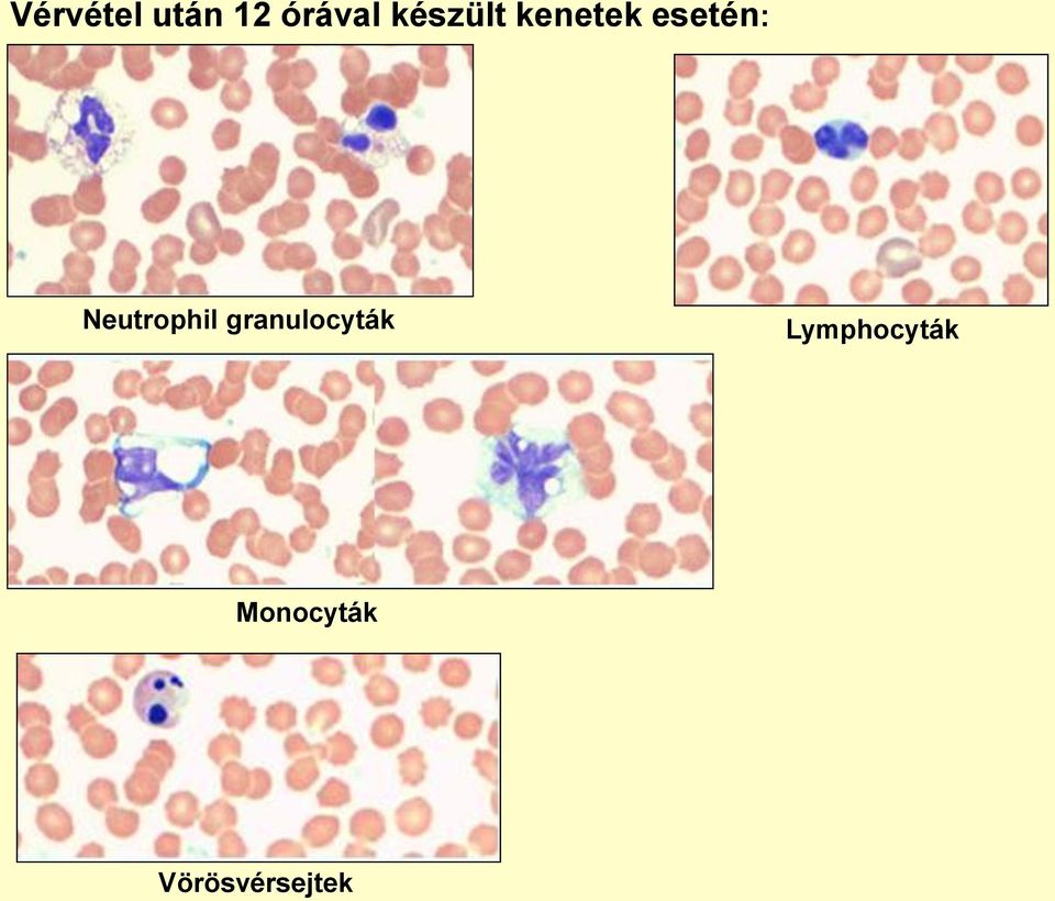 kenetek esetén: Neutrophil