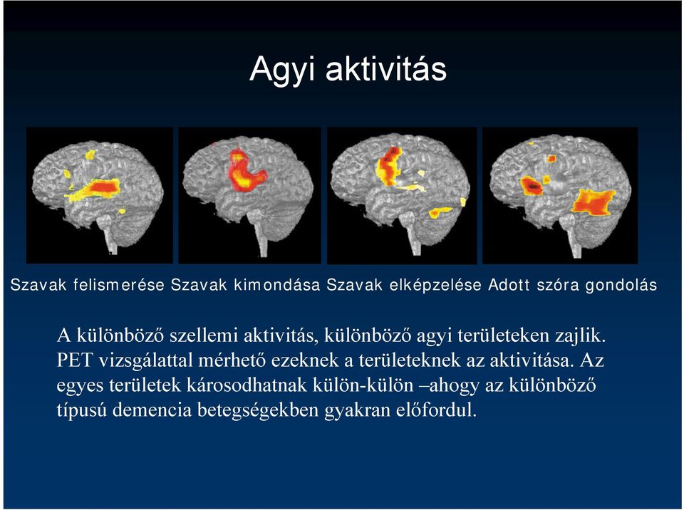 PET vizsgálattal mérhető ezeknek a területeknek az aktivitása.