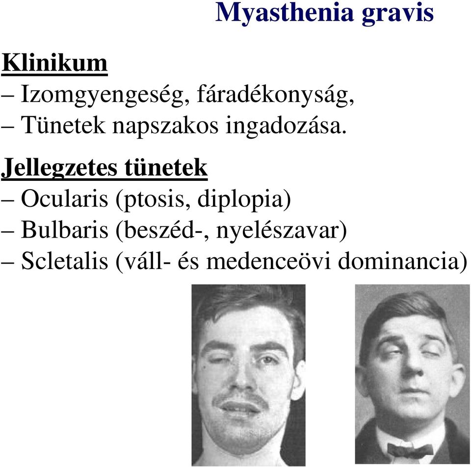 Jellegzetes tünetek Ocularis (ptosis, diplopia)