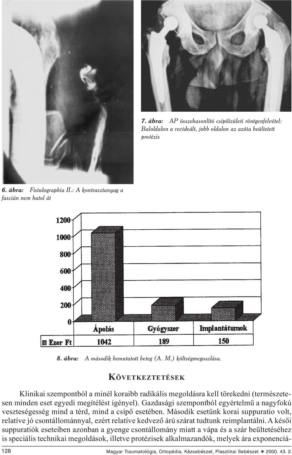 KÖVETKEZTETÉSEK Klinikai szempontból a minél koraibb radikális megoldásra kell törekedni (természetesen minden eset egyedi megítélést igényel).