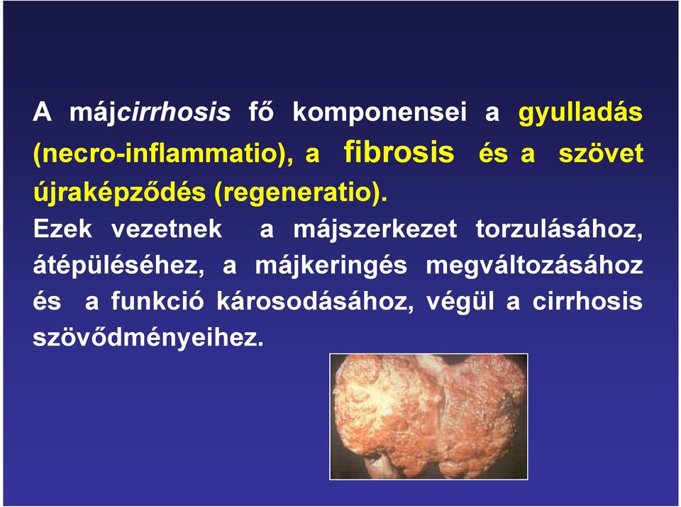 Ezek vezetnek a májszerkezet torzulásához, átépüléséhez, a