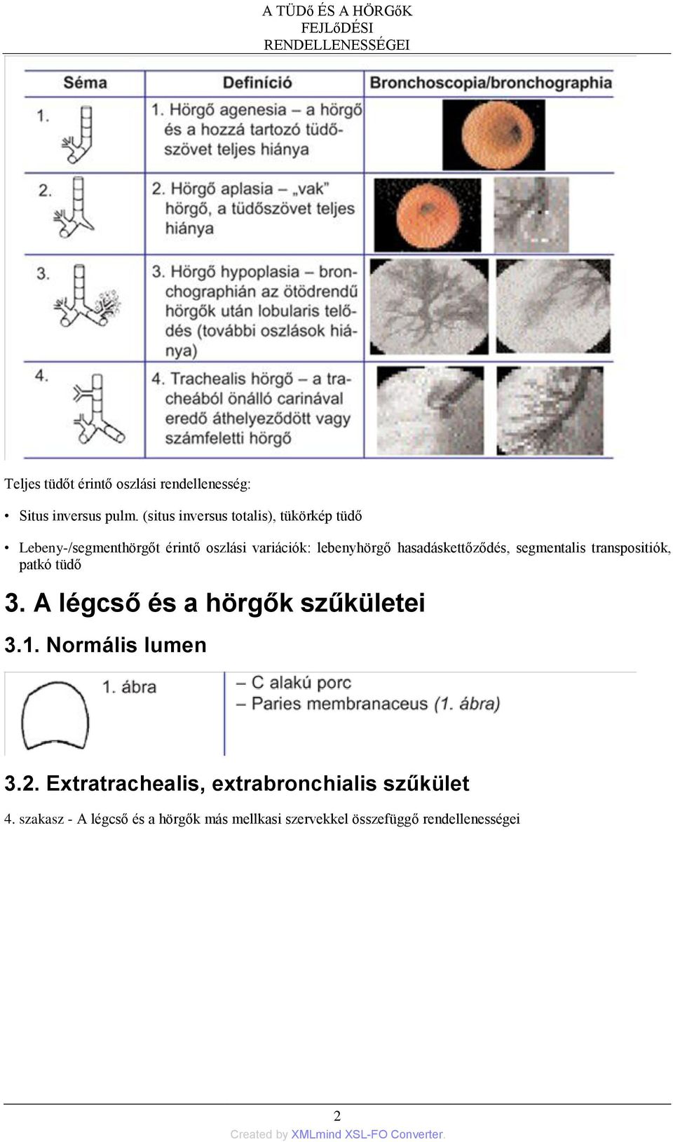 hasadáskettőződés, segmentalis transpositiók, patkó tüdő 3. A légcső és a hörgők szűkületei 3.1. Normális lumen 3.