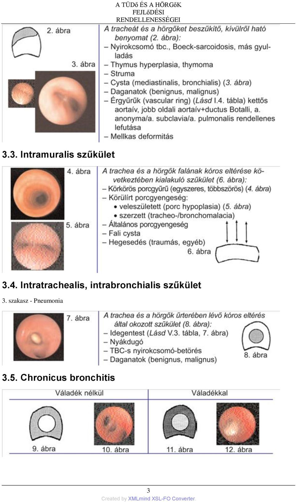 3. Intramuralis szűkület 3.4.