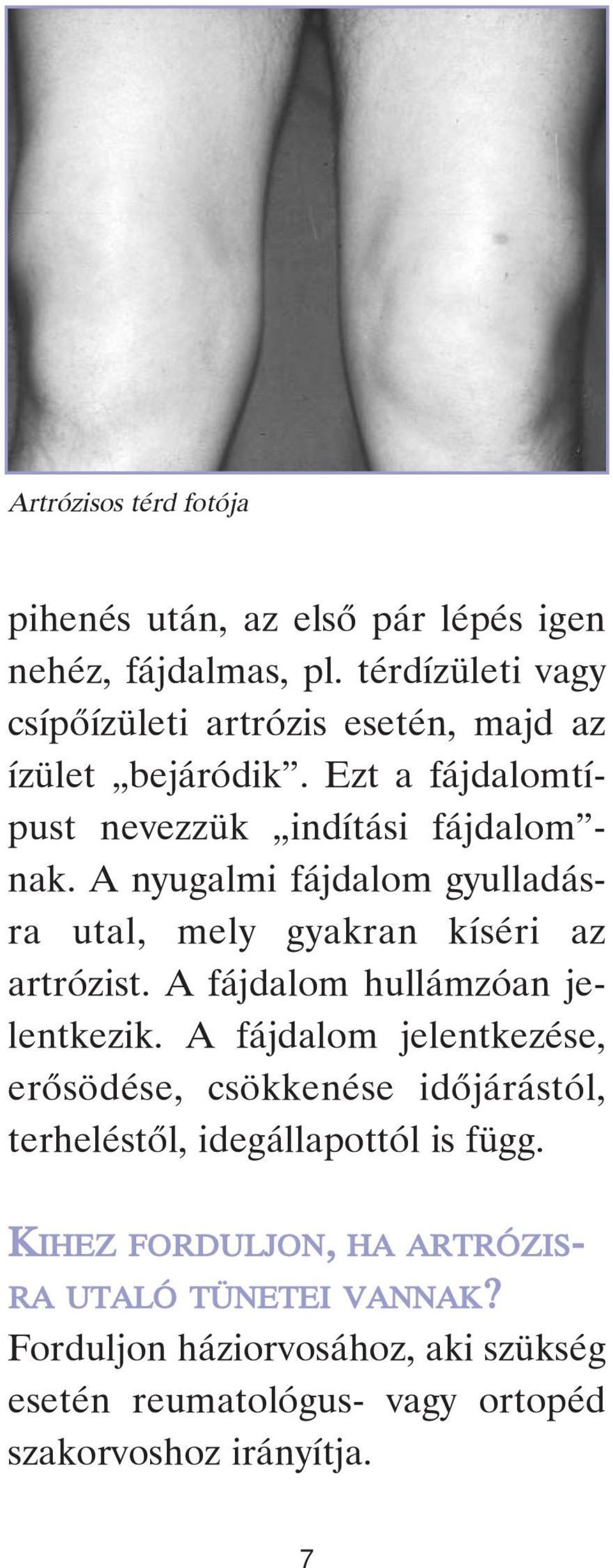 A nyugalmi fájdalom gyulladásra utal, mely gyakran kíséri az artrózist. A fájdalom hullámzóan jelentkezik.