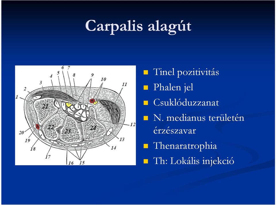 Csuklóduzzanat N.