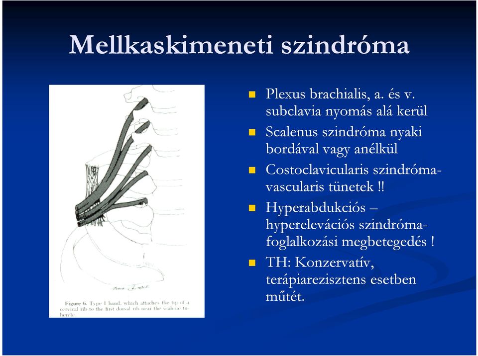 Costoclavicularis szindróma- vascularis tünetek!