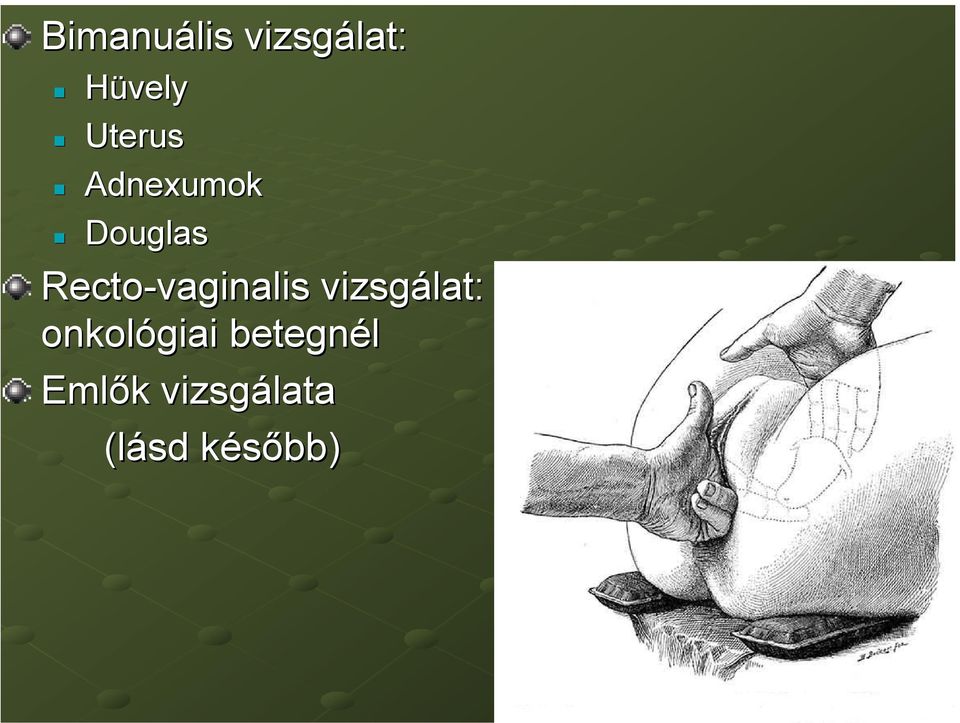 Recto-vaginalis vizsgálat: