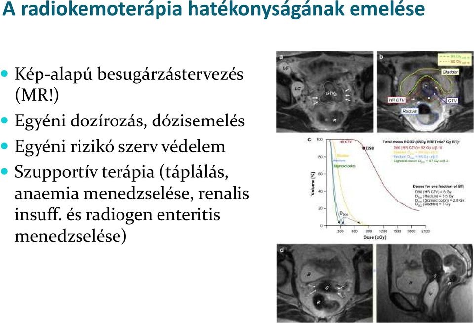 ) Egyéni dozírozás, dózisemelés Egyéni rizikó szerv védelem