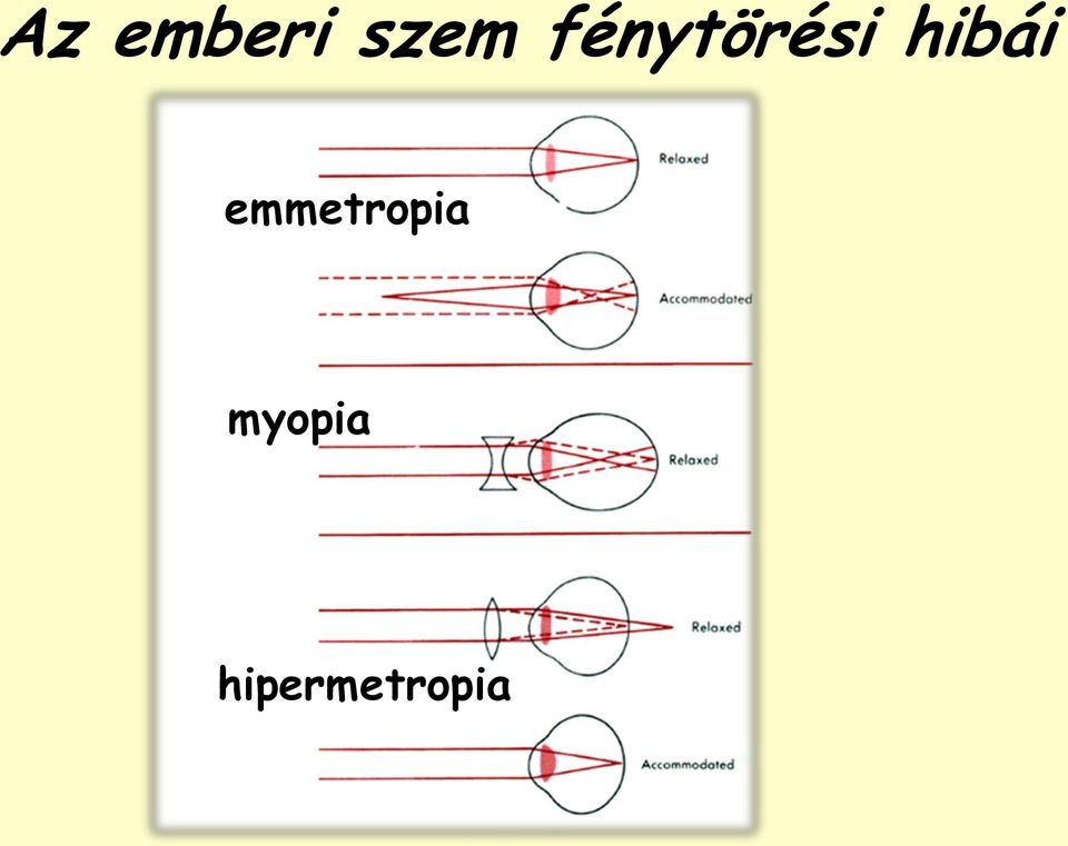 hibái