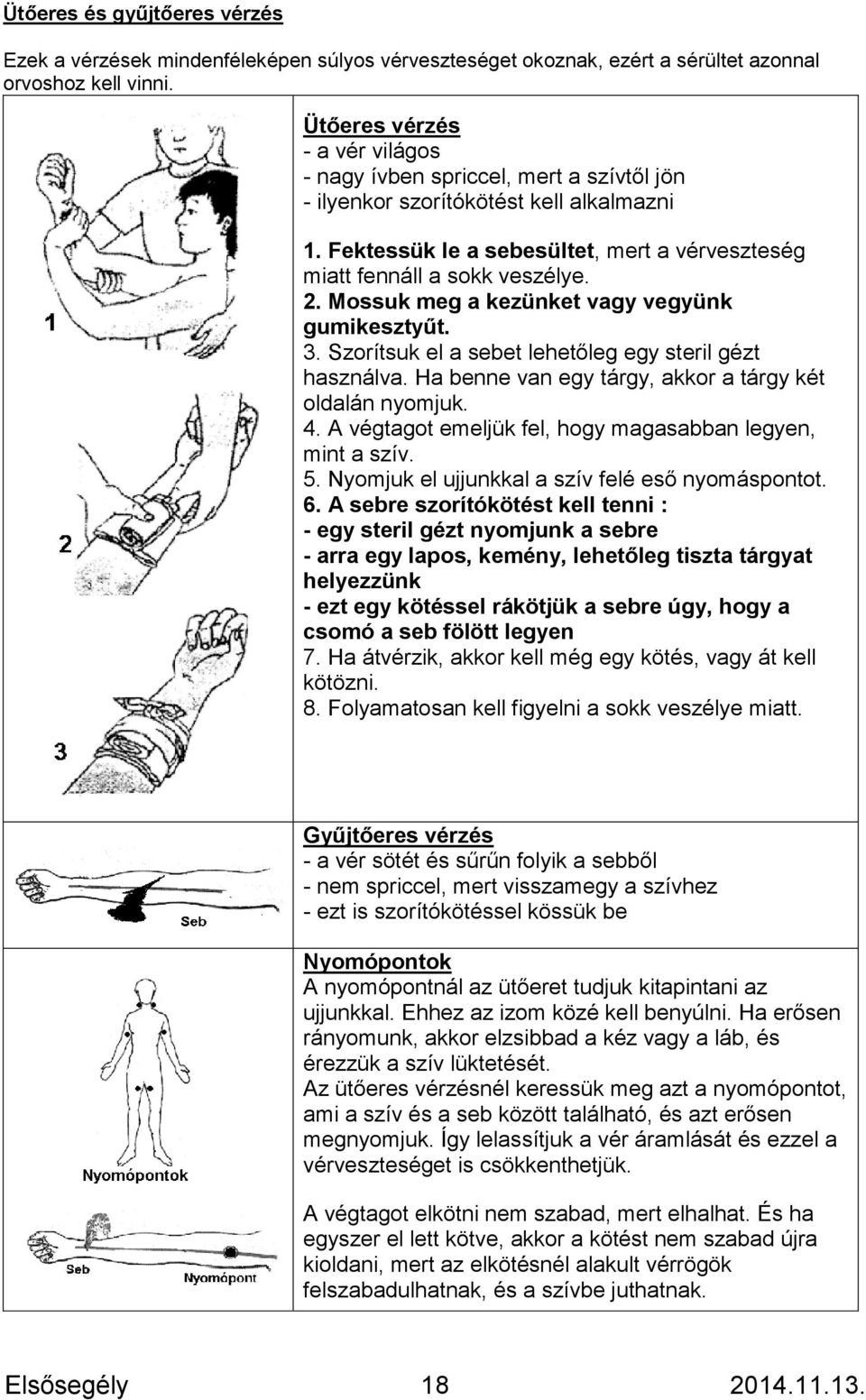 Mossuk meg a kezünket vagy vegyünk gumikesztyűt. 3. Szorítsuk el a sebet lehetőleg egy steril gézt használva. Ha benne van egy tárgy, akkor a tárgy két oldalán nyomjuk. 4.