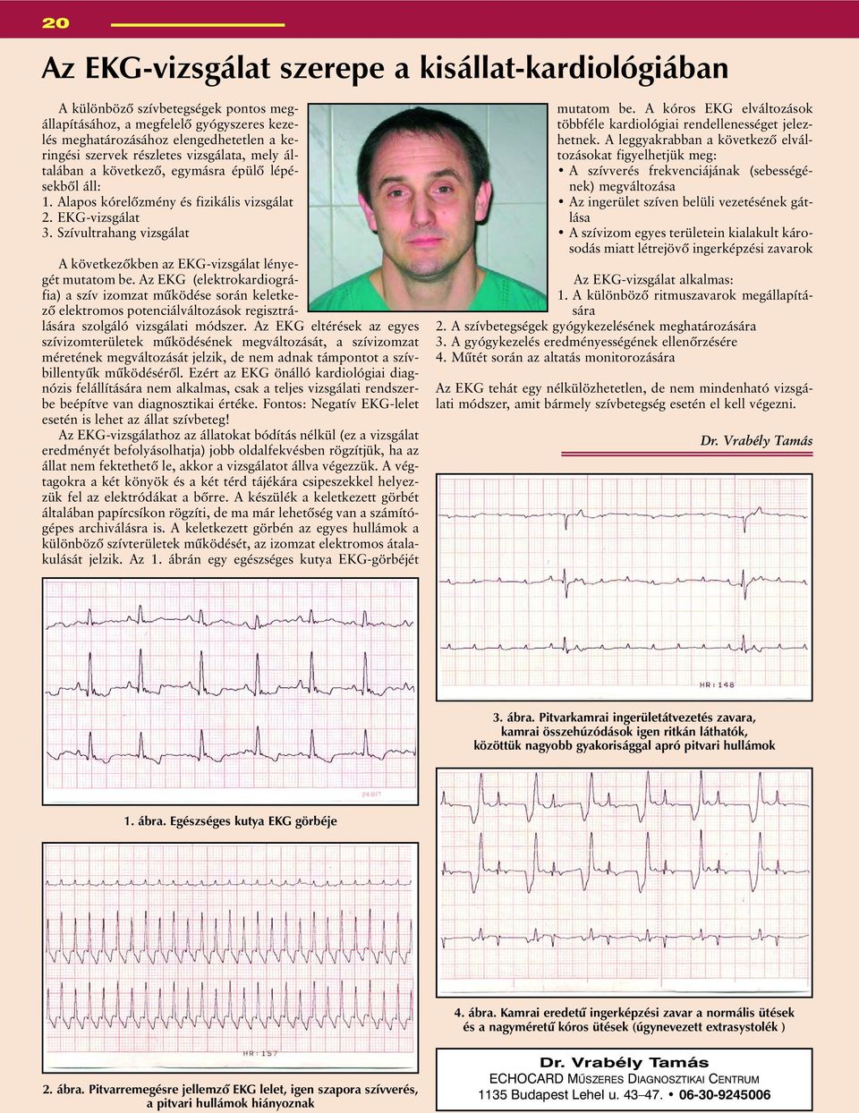Szívultrahang vizsgálat A következõkben az EKG-vizsgálat lényegét mutatom be.