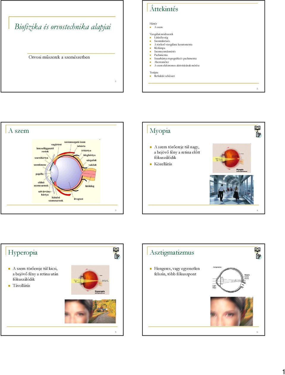 aktivitásának mérése Terápia 1 2 A szem Myopia A szem törőereje túl nagy, a bejövő fény a retina előtt fókuszálódik Közellátás 3 4 Hyperopia