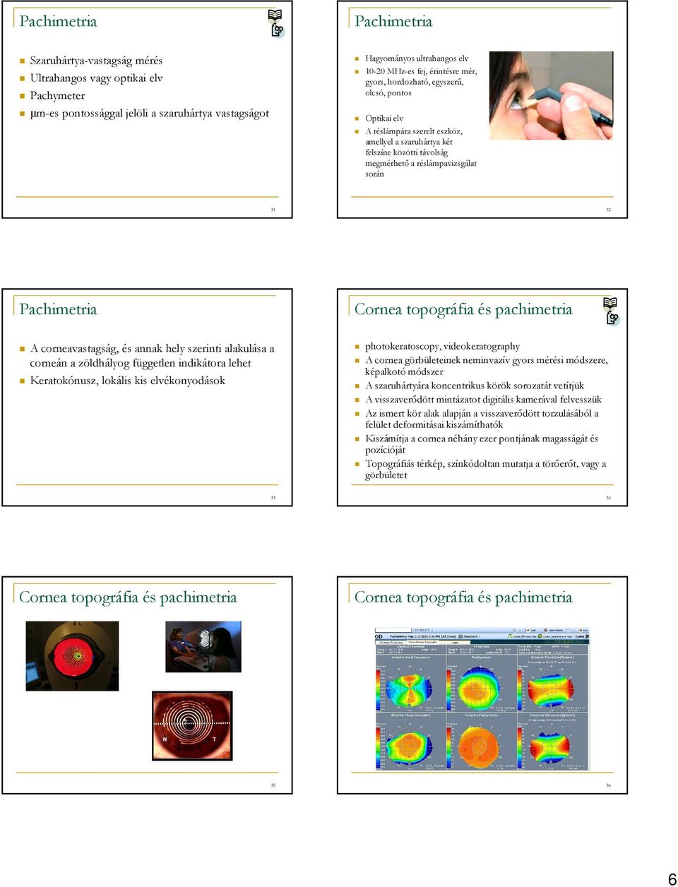 Cornea topográfia és pachimetria A corneavastagság, és annak hely szerinti alakulása a corneán a zöldhályog független indikátora lehet Keratokónusz, lokális kis elvékonyodások photokeratoscopy,