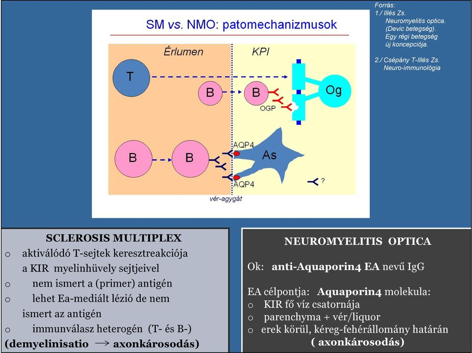 lehet Ea-mediált lézió de nem ismert az antigén o immunválasz heterogén (T- és B-) (demyelinisatio axonkárosodás) NEUROMYELITIS OPTICA Ok: