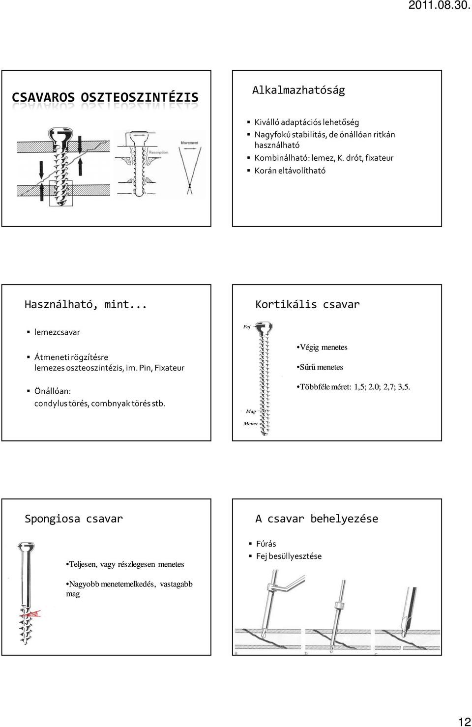 .. Kortikális csavar lemezcsavar Átmeneti rögzítésre lemezes oszteoszintézis, im.