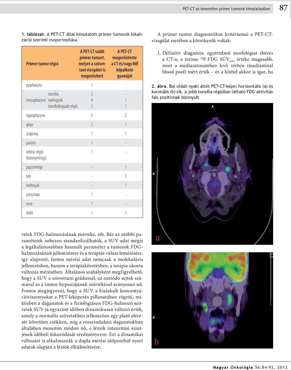 is képalkotó megerősített gyanúját epipharynx - tonsilla - mesopharynx nyelvgyök tonsillolingualis régió hypopharynx gége szájüreg parotis - orbita-régió - (könnymirigy) pajzsmirigy - bőr - méhnyak -