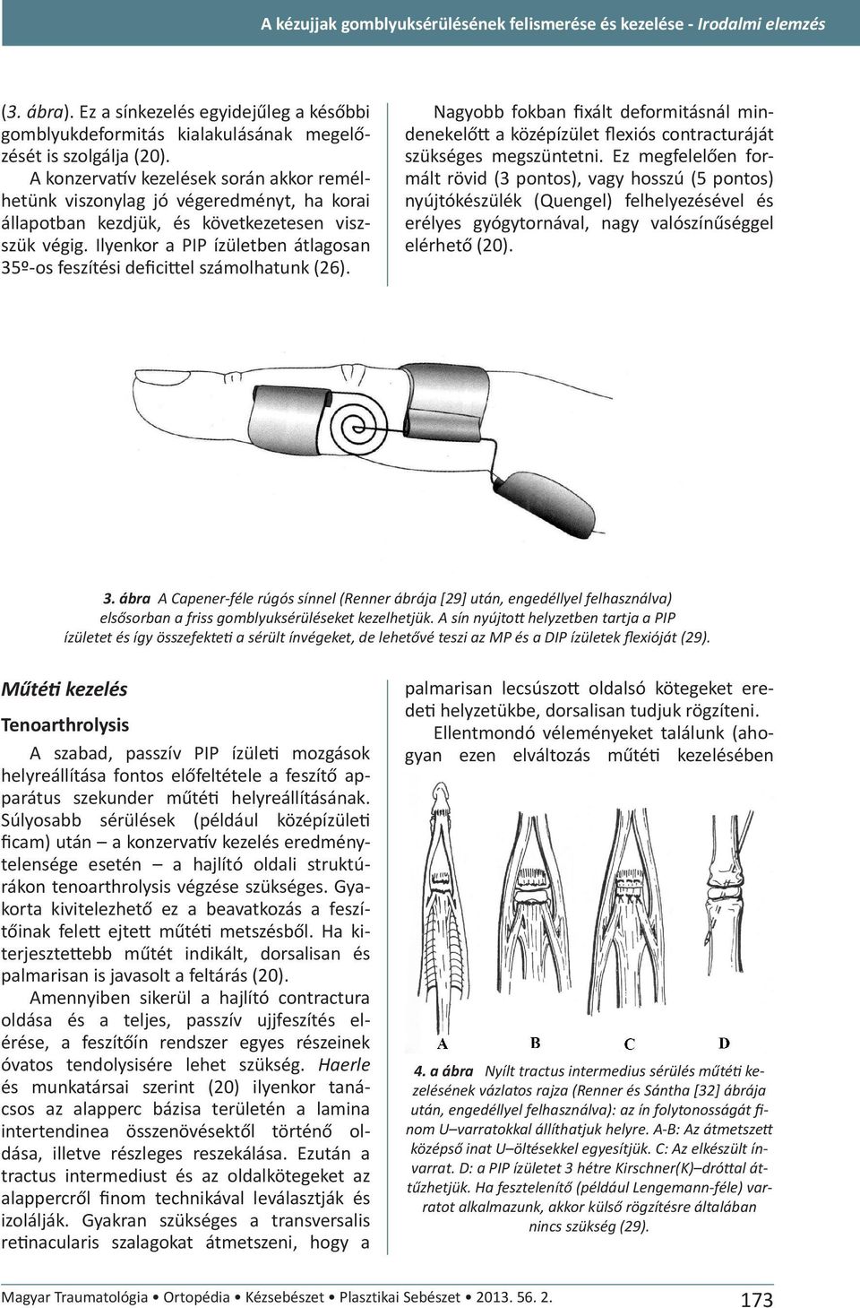 Ilyenkor a PIP ízületben átlagosan 35º-os feszítési deficittel számolhatunk (26). Nagyobb fokban fixált deformitásnál mindenekelőtt a középízület flexiós contracturáját szükséges megszüntetni.
