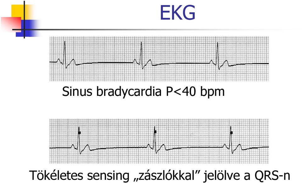 bpm Tökéletes