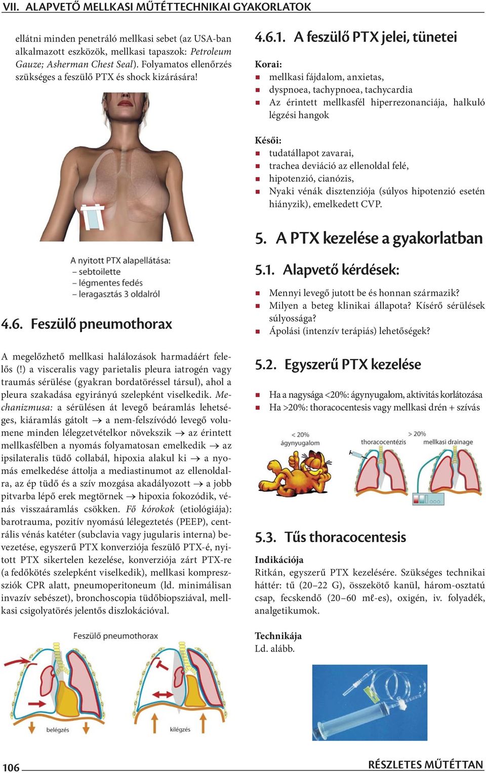 A feszülő PTX jelei, tünetei Korai: mellkasi fájdalom, anxietas, dyspnoea, tachypnoea, tachycardia Az érintett mellkasfél hiperrezonanciája, halkuló légzési hangok Késői: tudatállapot zavarai,