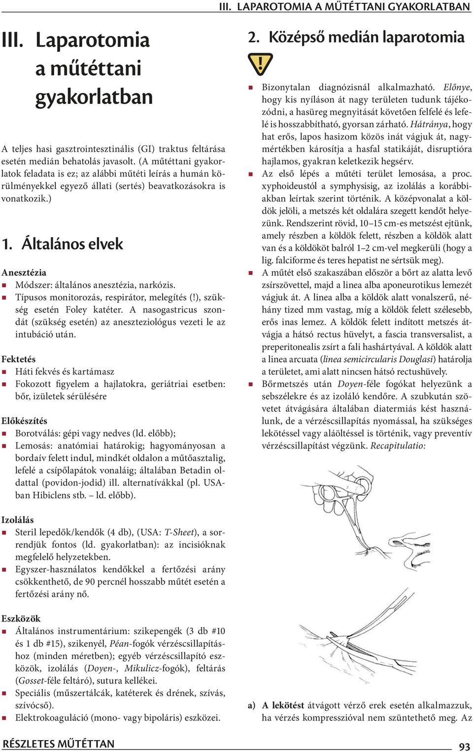 Általános elvek Anesztézia Módszer: általános anesztézia, narkózis. Típusos monitorozás, respirátor, melegítés (!), szükség esetén Foley katéter.