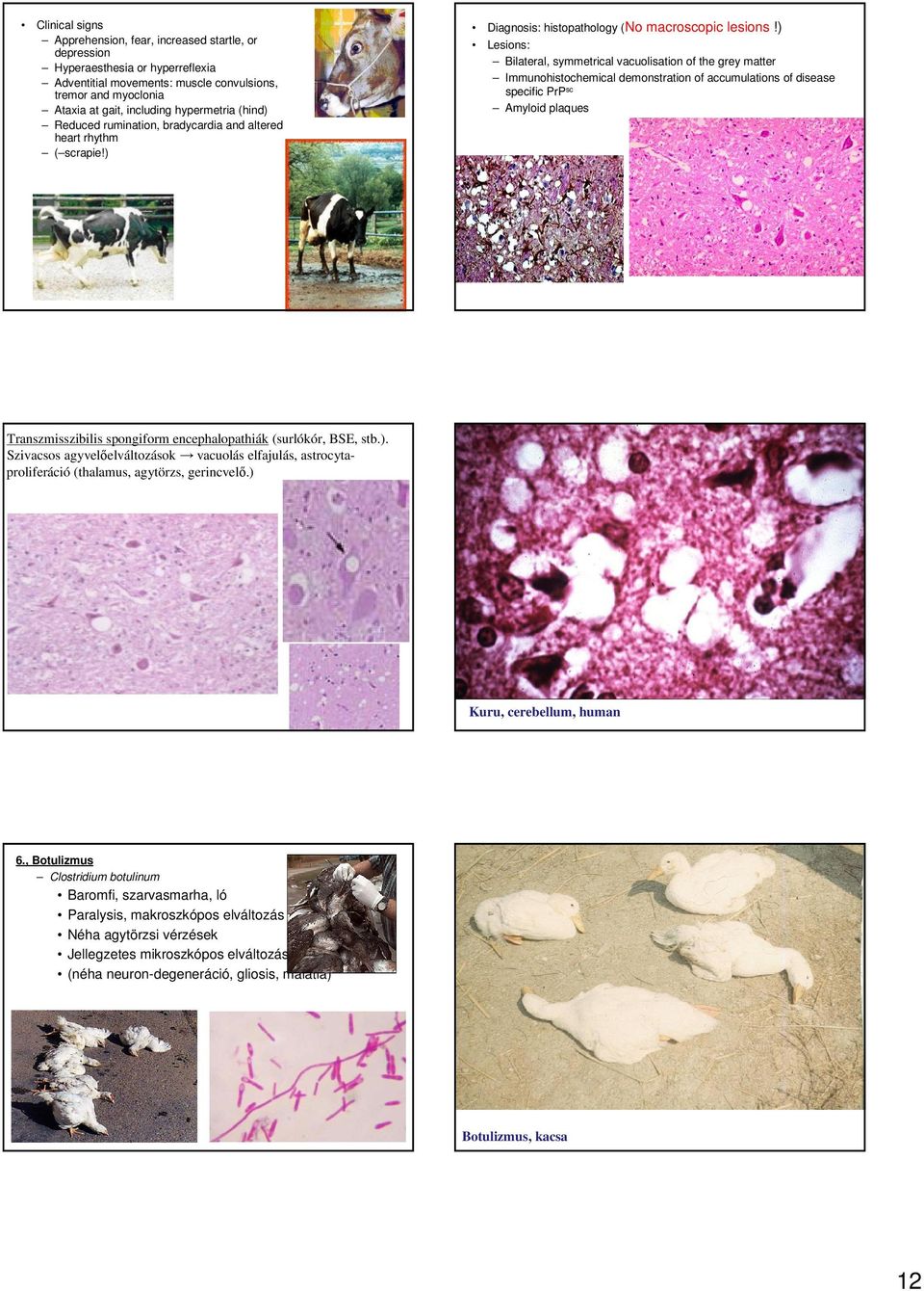 ) Lesions: Bilateral, symmetrical vacuolisation of the grey matter Immunohistochemical demonstration of accumulations of disease specific PrP sc Amyloid plaques Transzmisszibilis spongiform