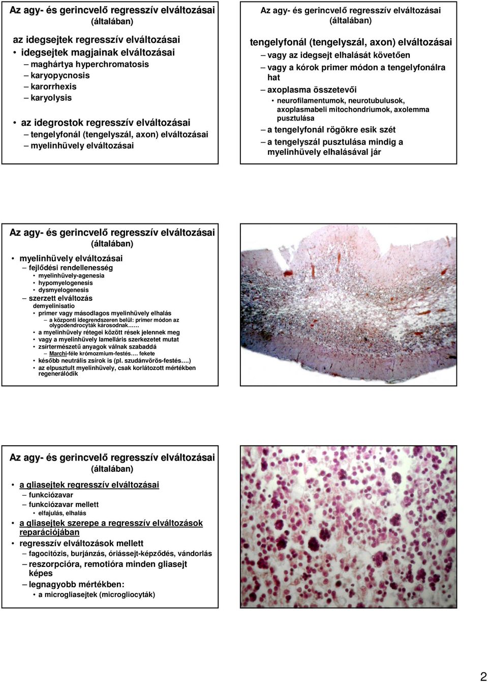 hat axoplasma összetevıi neurofilamentumok, neurotubulusok, axoplasmabeli mitochondriumok, axolemma pusztulása a tengelyfonál rögökre esik szét a tengelyszál pusztulása mindig a myelinhüvely