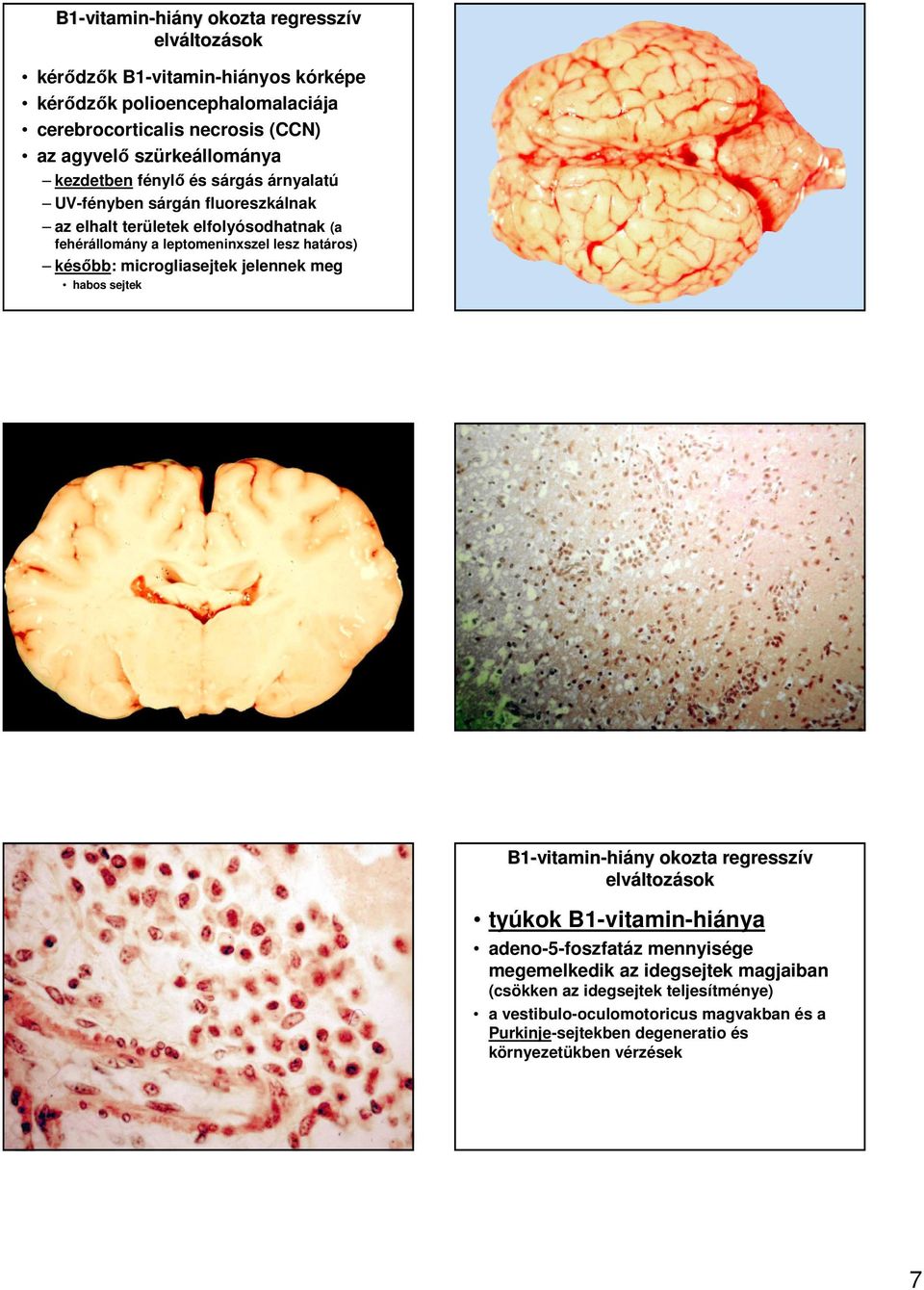 határos) késıbb: microgliasejtek jelennek meg habos sejtek B1-vitamin vitamin-hiány okozta regresszív tyúkok B1-vitamin-hiánya adeno-5-foszfatáz mennyisége