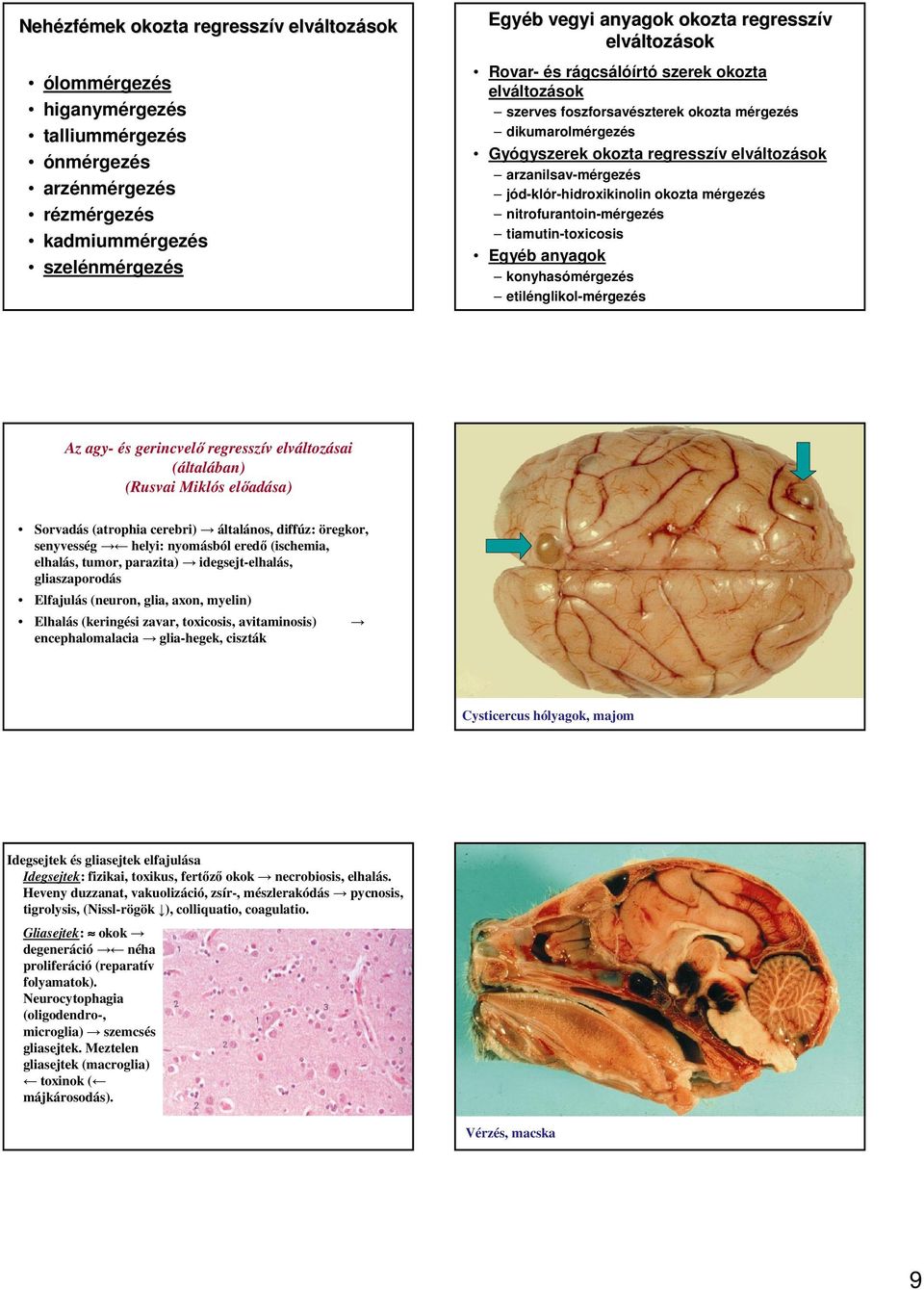 nitrofurantoin-mérgezés tiamutin-toxicosis Egyéb anyagok konyhasómérgezés etilénglikol-mérgezés Az agy- és gerincvelı regresszív ásai (Rusvai Miklós elıadása) Sorvadás (atrophia cerebri) általános,