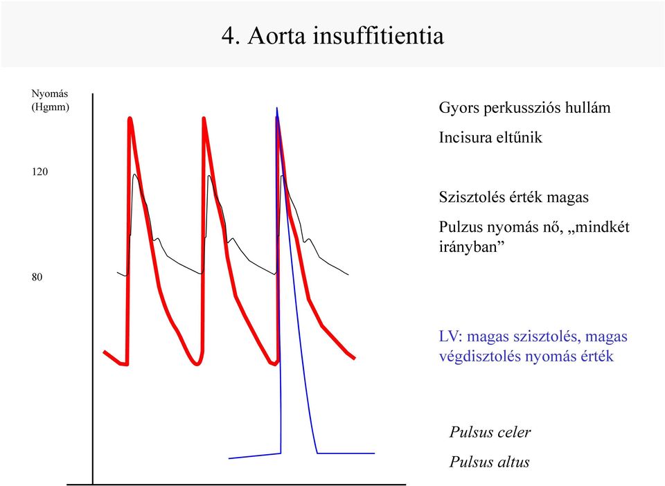 magas Pulzus nyomás nő, mindkét irányban 80 LV: magas