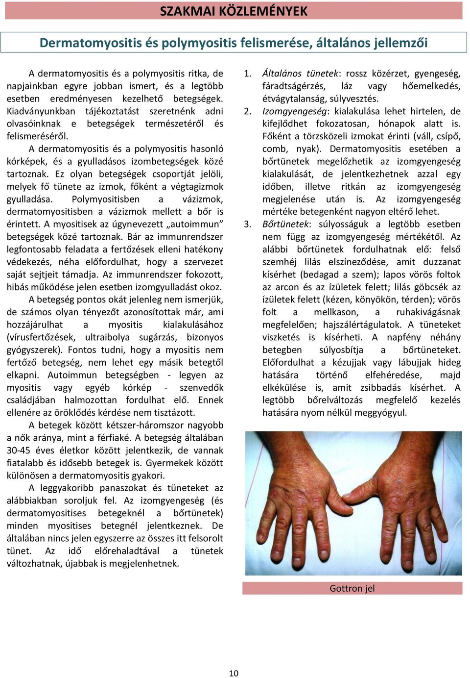 A dermatomyositis és a polymyositis hasonló kórképek, és a gyulladásos izombetegségek közé tartoznak. Ez olyan betegségek csoportját jelöli, melyek fő tünete az izmok, főként a végtagizmok gyulladása.