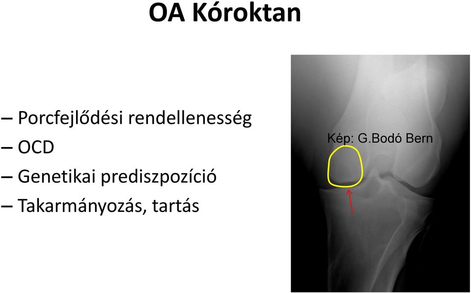 Genetikai prediszpozíció