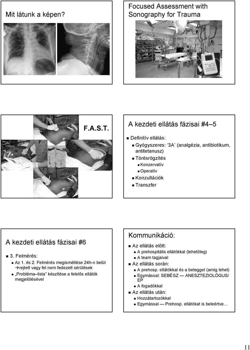 A kezdeti ellátás fázisai #4 5 Definitív ellátás: Gyógyszeres: 3A (analgézia, antibiotikum, antitetanusz) Törésrögzítés Konzervatív Operatív Konzultációk Transzfer A kezdeti