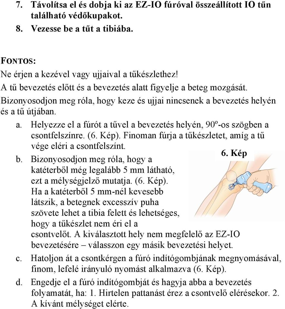 (6. Kép). Finoman fúrja a tűkészletet, amíg a tű vége eléri a csontfelszínt. 6. Kép b. Bizonyosodjon meg róla, hogy a katéterből még legalább 5 mm látható, ezt a mélységjelző mutatja. (6. Kép). Ha a katéterből 5 mm-nél kevesebb látszik, a betegnek excesszív puha szövete lehet a tibia felett és lehetséges, hogy a tűkészlet nem éri el a csontvelőt.