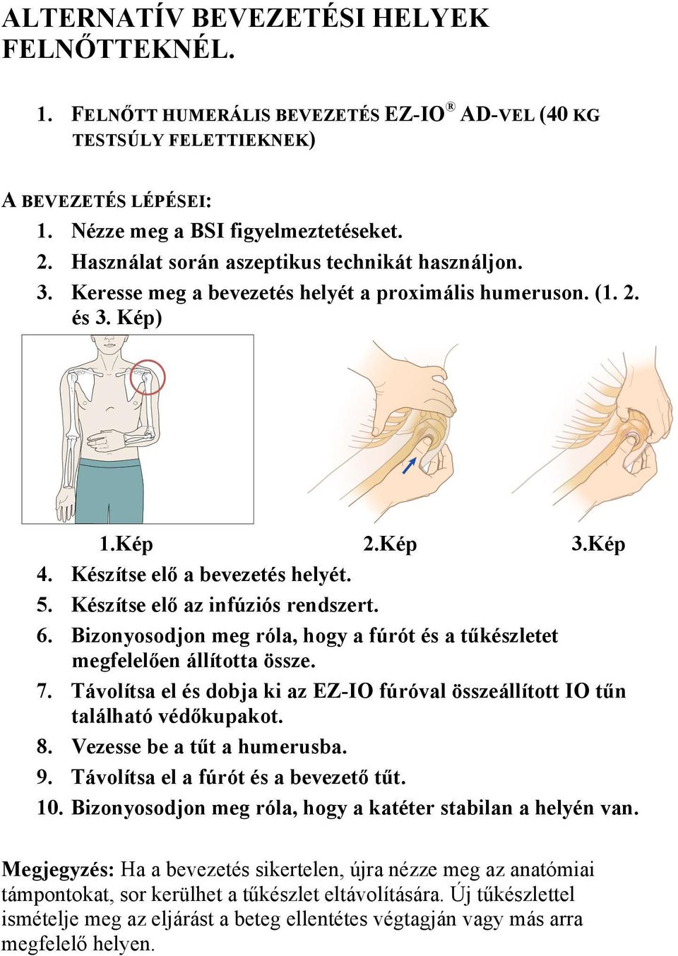 Készítse elő az infúziós rendszert. 6. Bizonyosodjon meg róla, hogy a fúrót és a tűkészletet megfelelően állította össze. 7.